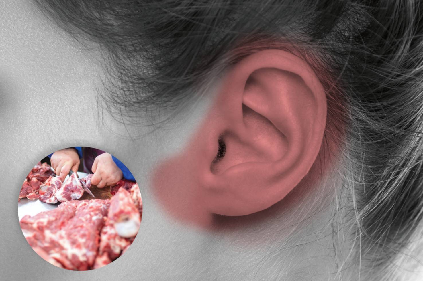 ผู้ป่วยไข้หวัดใหญ่